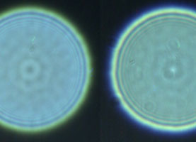 Тест Родье – отличные результаты!